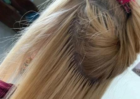 plauku priauginimas naudojant nano sruogas